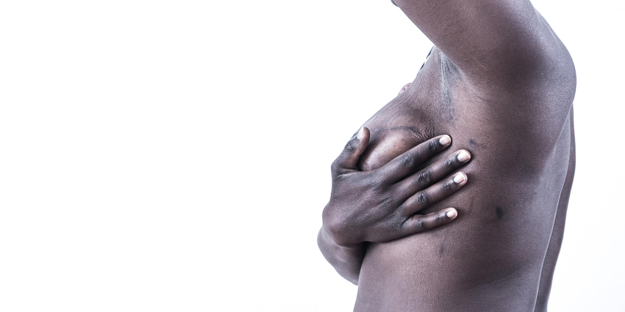 Breast cancer is the most common cancer in the world. 5 reads that could save lives
