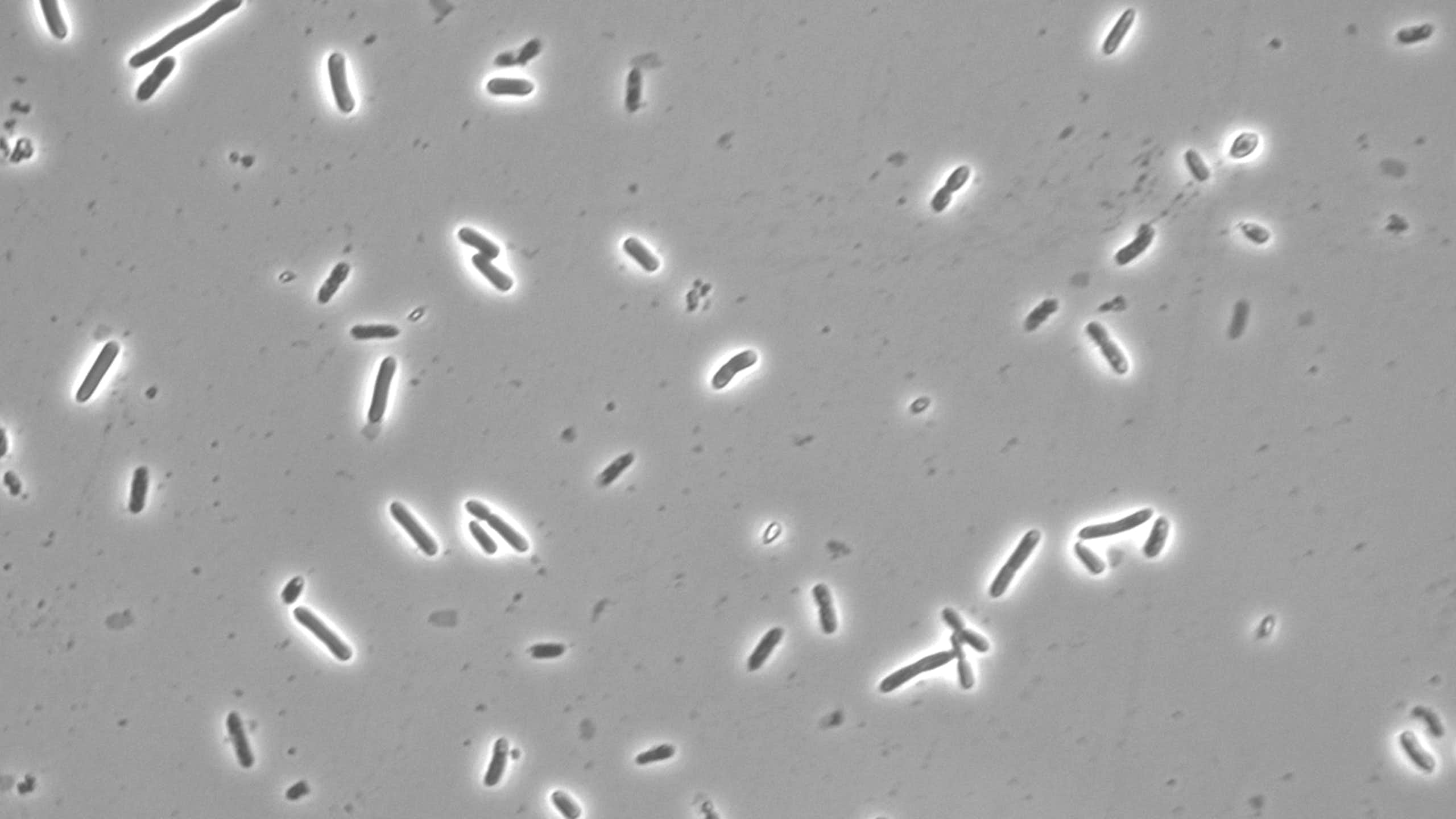 close up of rod-shaped microbes on grey background from microscope