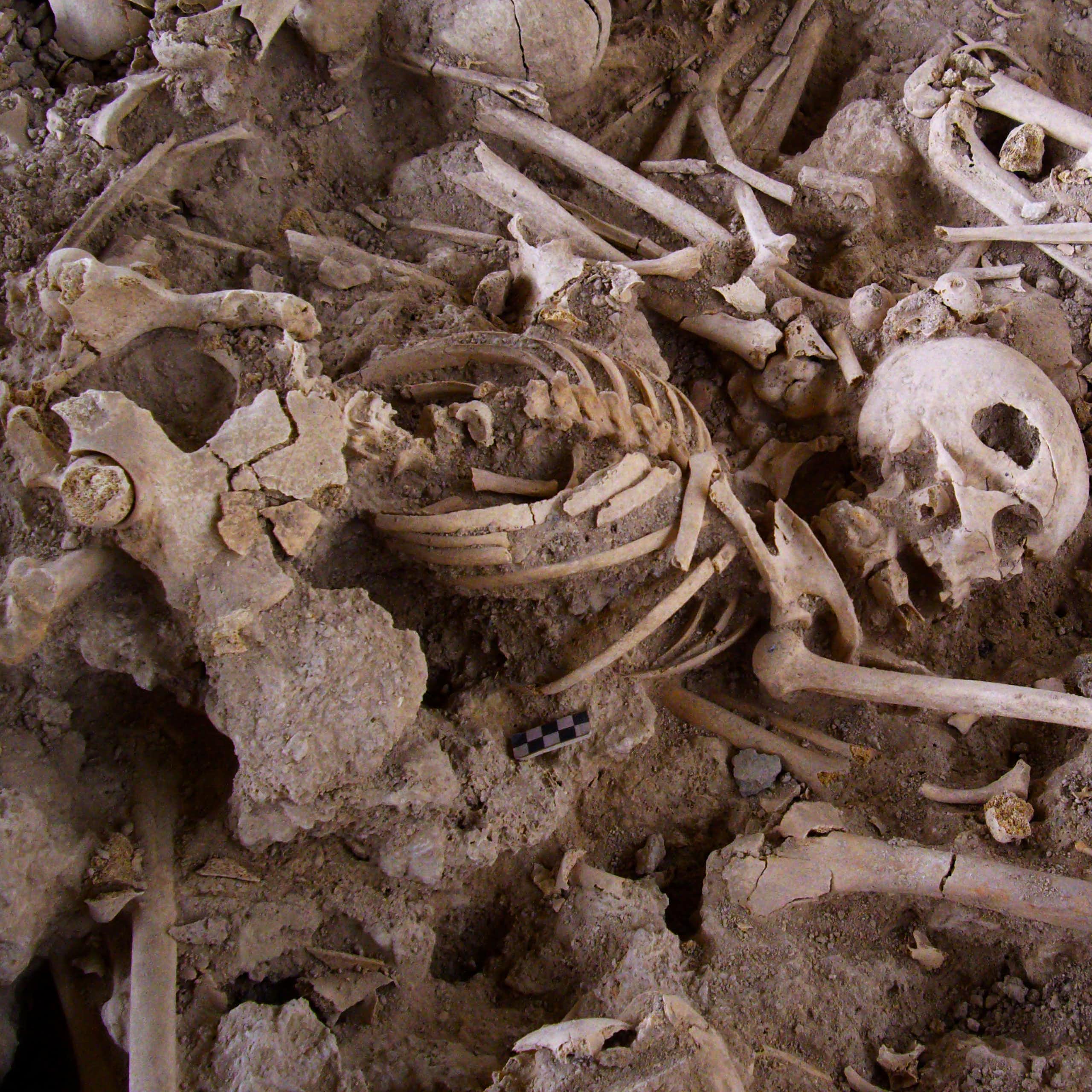 El éxito de la cirugía craneal en la prehistoria