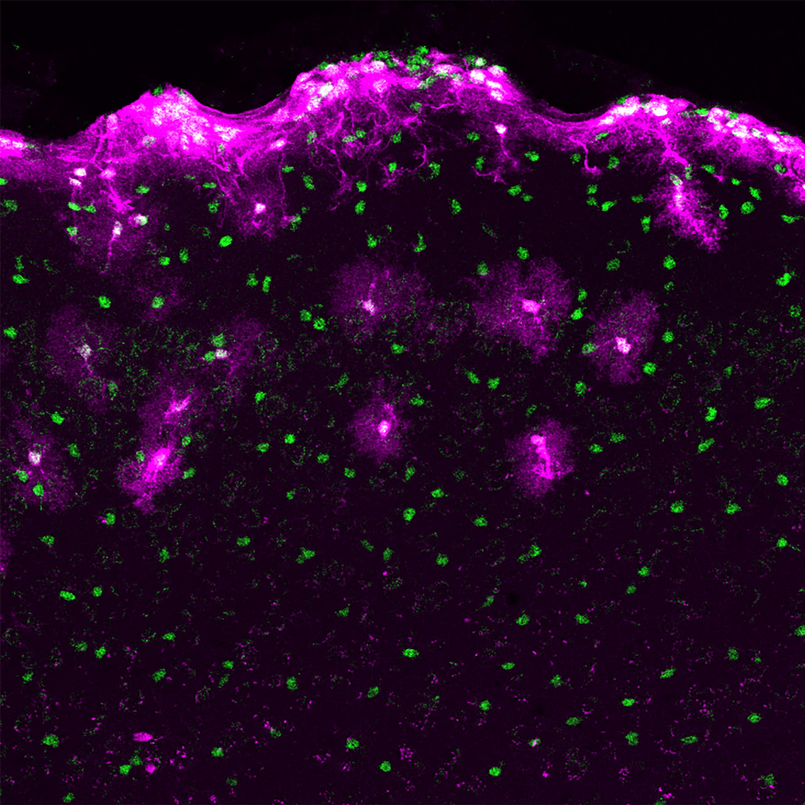 purple star-shaped cells against a black background with green dots