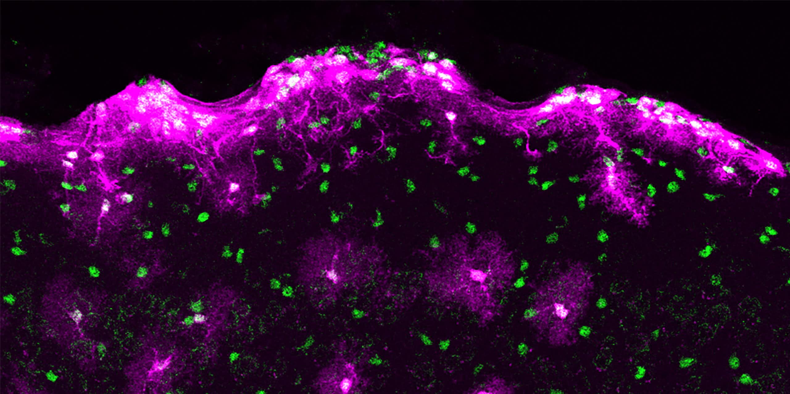purple star-shaped cells against a black background with green dots